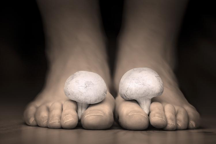 What Causes Nail Fungus