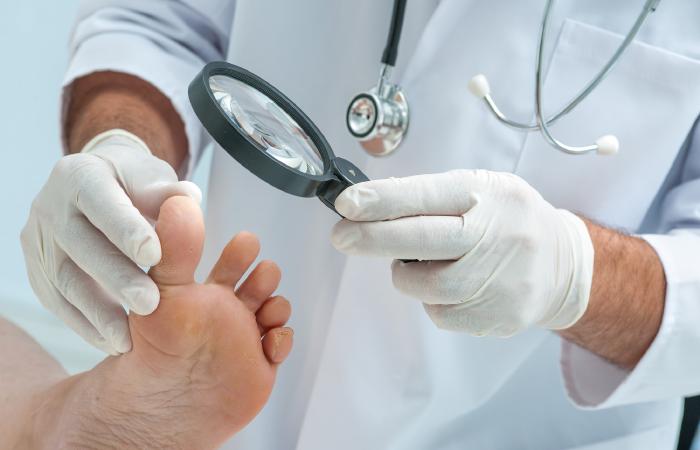 Nail Fungus Treatment